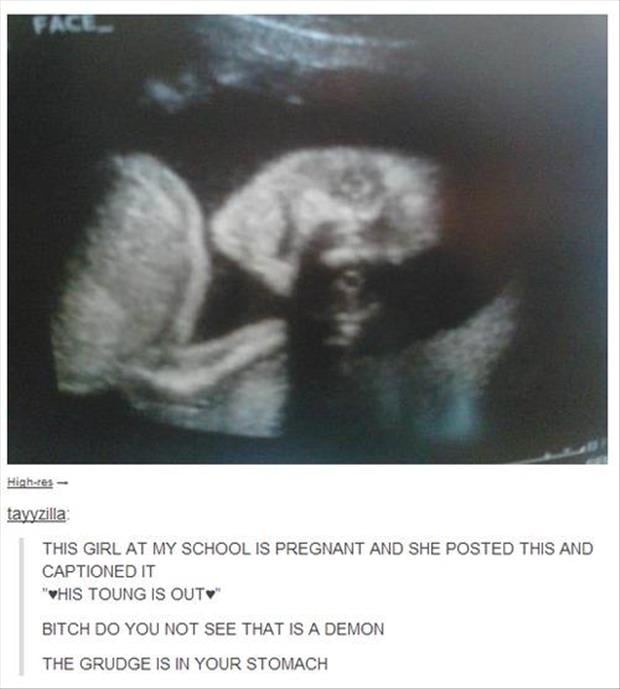 funny ultra sound pictures