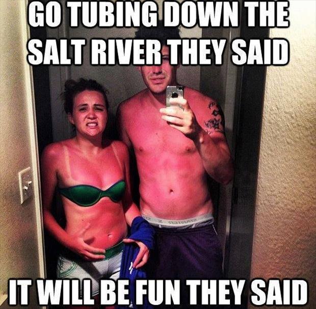sunburns funny pictures