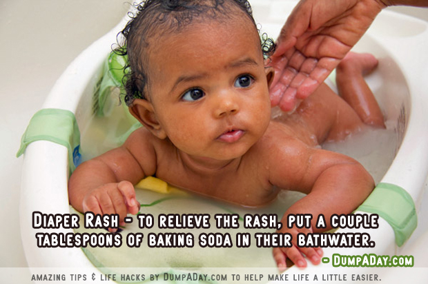 Amazing uses for Baking Soda- Diaper Rash