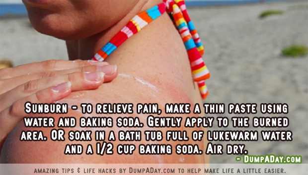 Amazing uses for Baking Soda- Sunburn