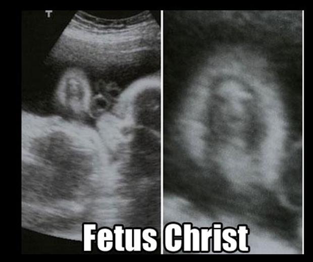 funny ultra sound pictures (14)