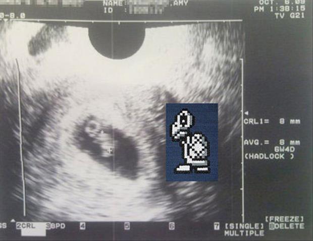 funny ultra sound pictures (19)
