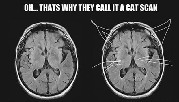 this is why they call it a cat scan