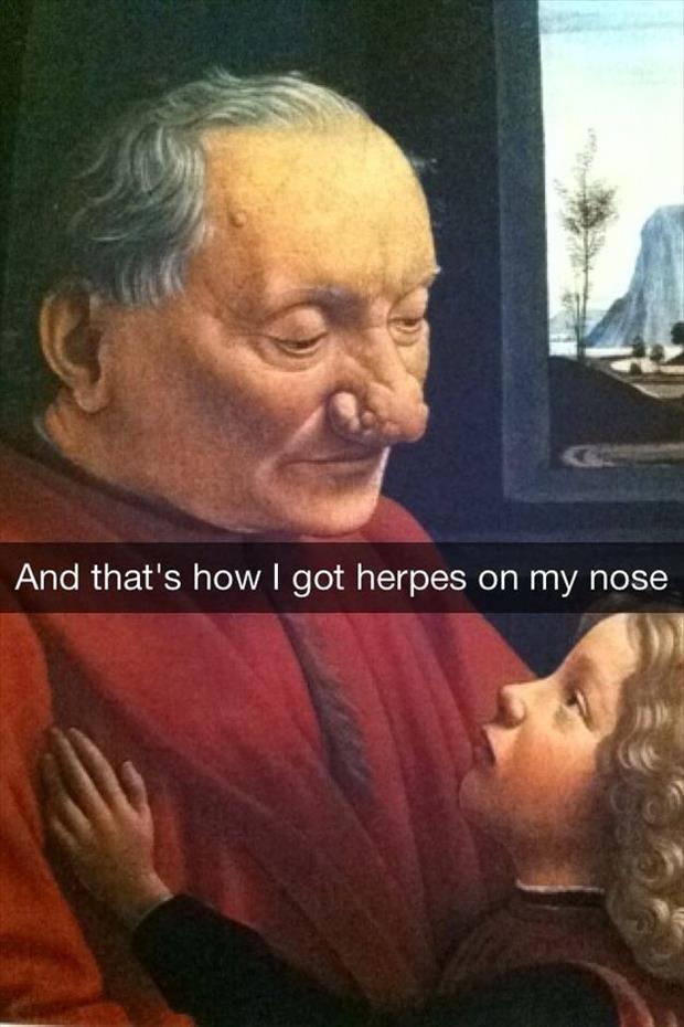 herpes