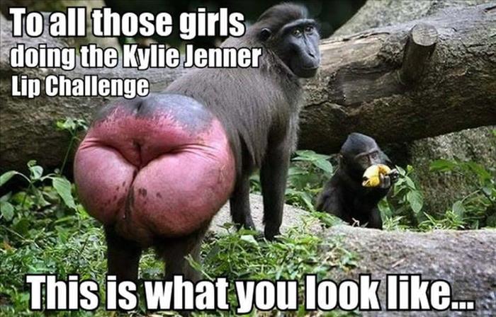 Kylie Jenner Lip Challenge