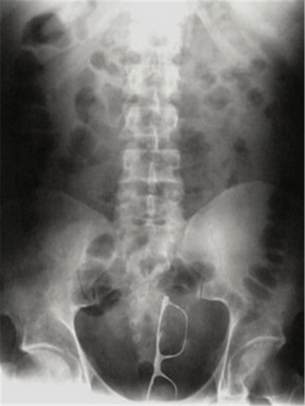 x rays up butt (1)