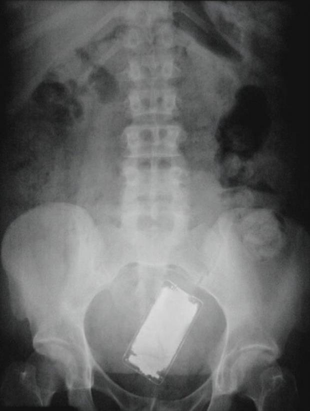 x rays up butt (11)