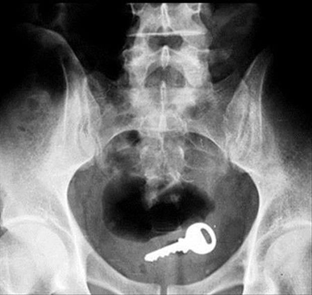 x rays up butt (12)