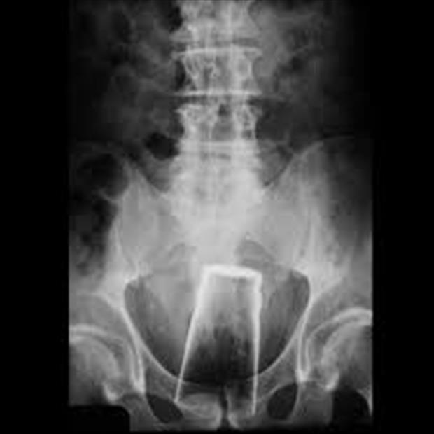 x rays up butt (13)