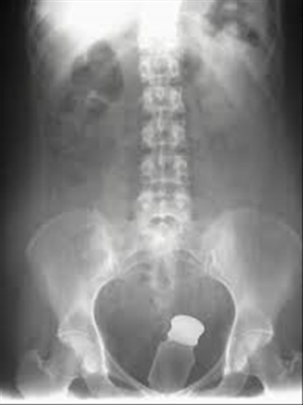 x rays up butt (2)