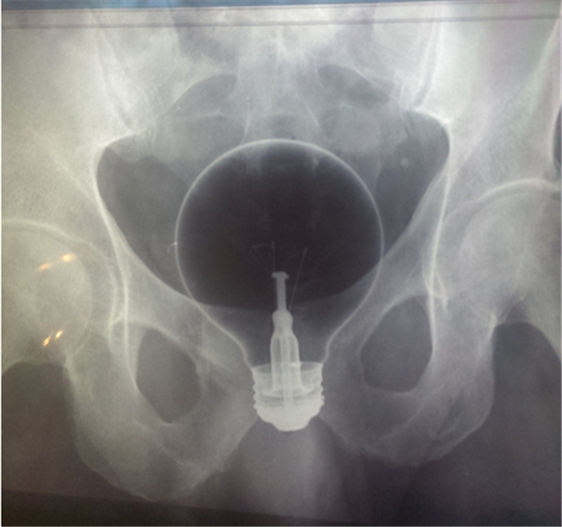 x rays up butt (2)