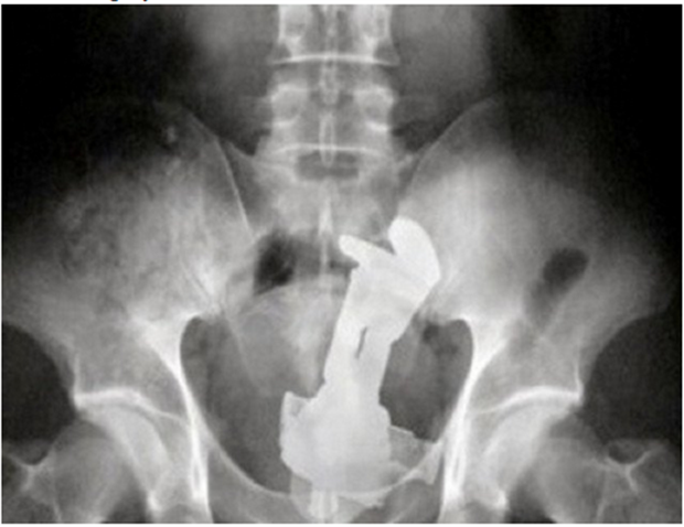 x rays up butt (3)