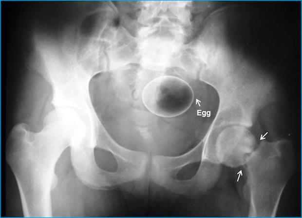 x rays up butt (7)