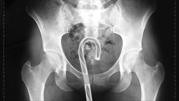 x rays up butt (9)