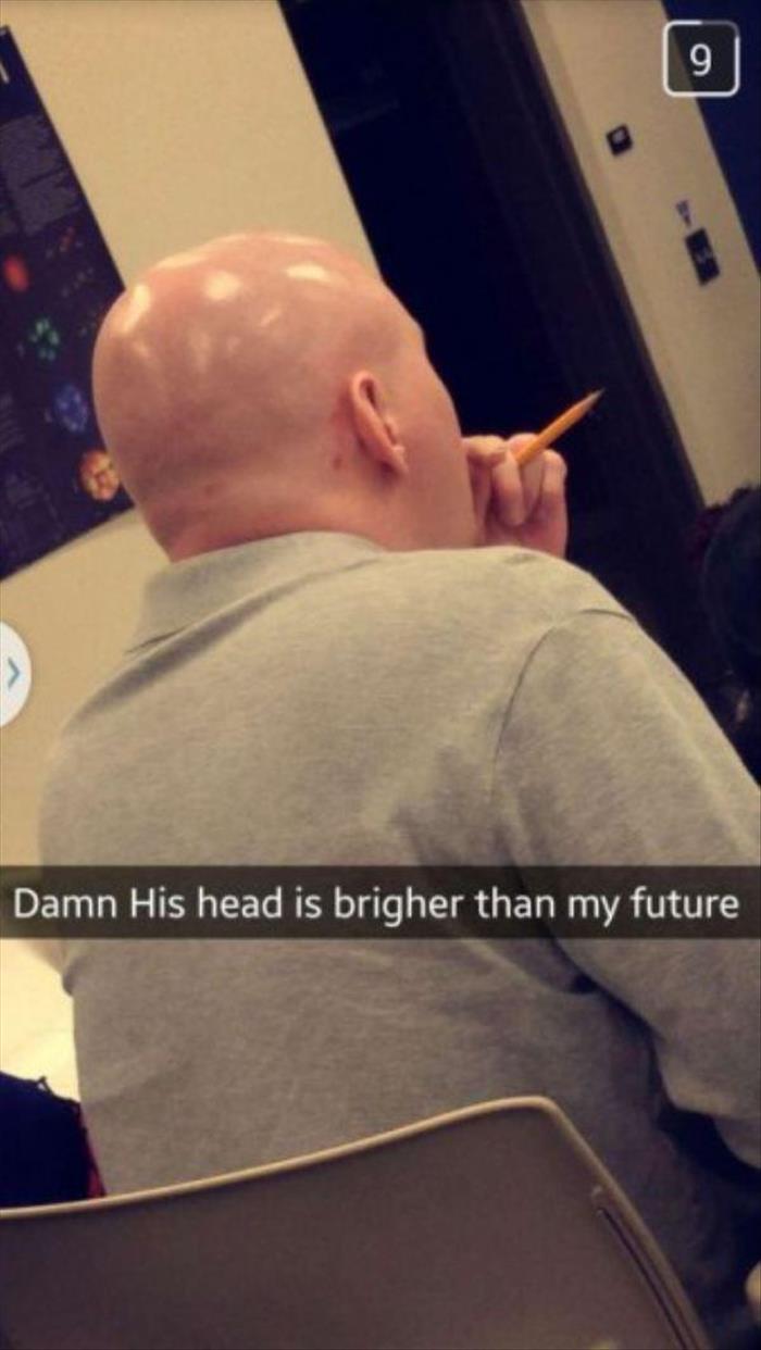 the bald man head
