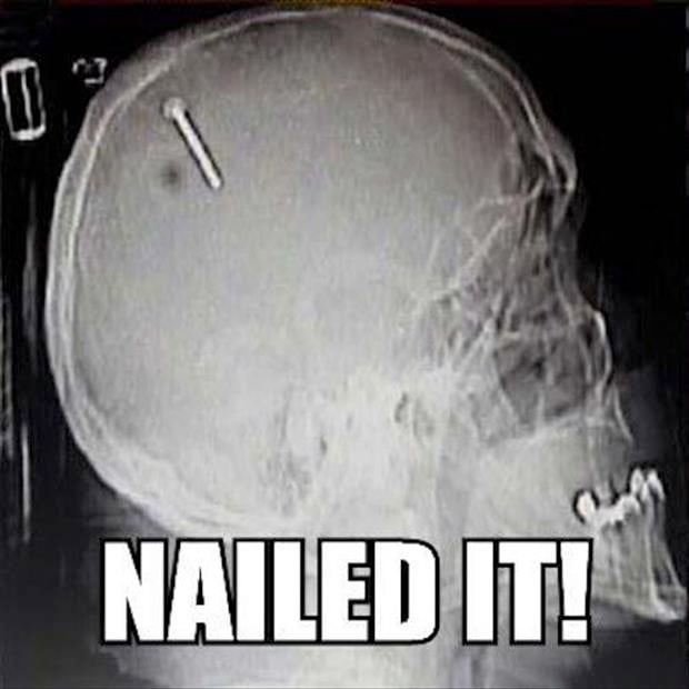 nailed it funny x rays.